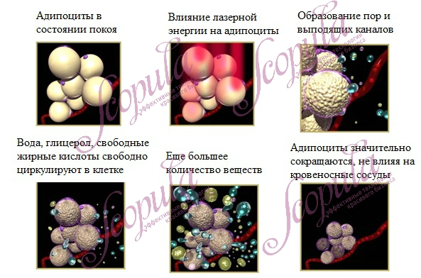 SA-LP2082.jpg